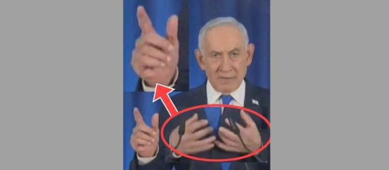 netanyahu 6 doigts