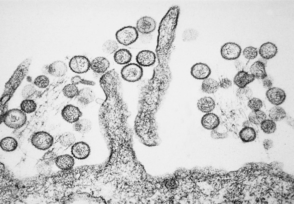 virus hanta1