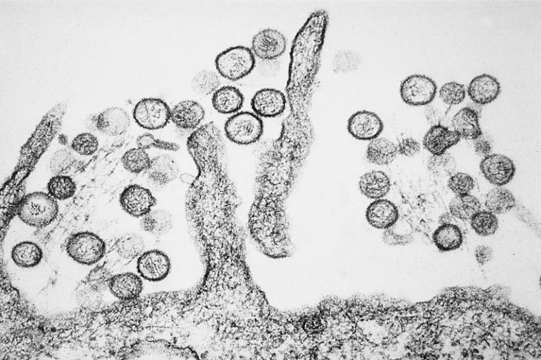 virus hanta1